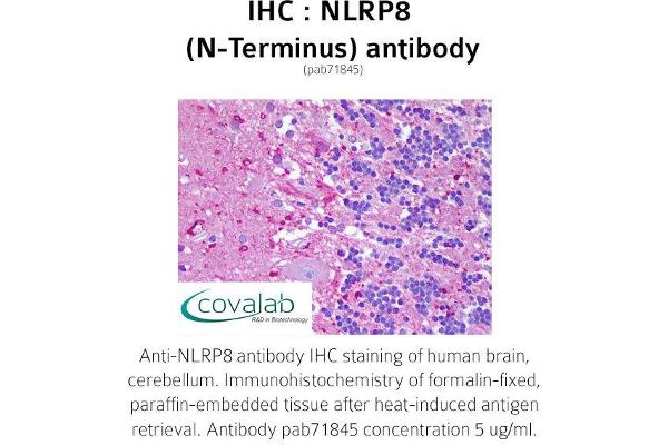 NALP8 antibody  (N-Term)