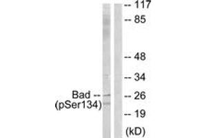 Western blot analysis of extracts from mouse liver, using BAD (Phospho-Ser134) Antibody.