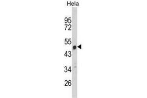 Image no. 1 for anti-Chromosome 9 Open Reading Frame 156 (C9orf156) (C-Term) antibody (ABIN452792)