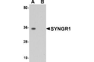 Image no. 2 for anti-Synaptogyrin 1 (SYNGR1) (Middle Region) antibody (ABIN1031113)