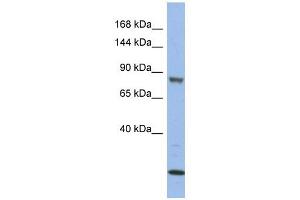 Image no. 1 for anti-Mitogen-Activated Protein Kinase Kinase Kinase 11 (MAP3K11) (Middle Region) antibody (ABIN634420)