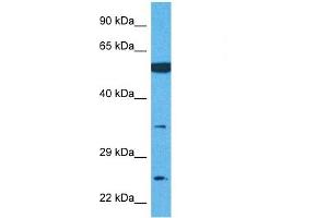 Image no. 2 for anti-Transmembrane Protein 158 (TMEM158) (Middle Region) antibody (ABIN2782853)