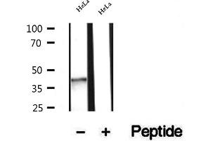 Image no. 1 for anti-NAD(P) Dependent Steroid Dehydrogenase-Like (NSDHL) (Internal Region) antibody (ABIN6263742)