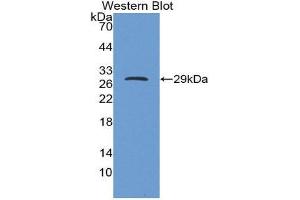 Image no. 1 for anti-Insulin-Like Growth Factor Binding Protein 5 (IGFBP5) (AA 25-271) antibody (ABIN2118244)