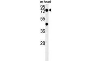 Image no. 1 for anti-Putative Homeodomain Transcription Factor 2 (PHTF2) (AA 388-418), (Middle Region) antibody (ABIN954130)