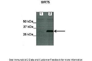 Image no. 2 for anti-Sirtuin 5 (SIRT5) (C-Term) antibody (ABIN2778619)