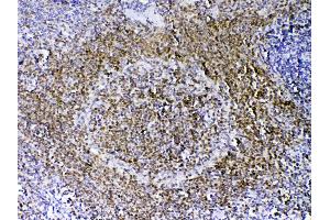 Image no. 4 for anti-Paired Box 5 (PAX5) (AA 217-282) antibody (ABIN5692907)