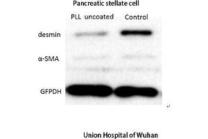 Image no. 3 for anti-Desmin (DES) (C-Term) antibody (ABIN3184287)