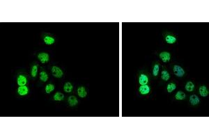 ICC/IF Image CDCA1 antibody [GT312] detects CDCA1 protein at cytoplasm and nucleus by immunofluorescent analysis.