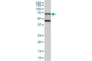 anti-Phosphoglucomutase 2 (PGM2) (AA 1-90) antibody