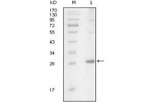 Image no. 1 for anti-IL2-Inducible T-Cell Kinase (ITK) (AA 2-110) antibody (ABIN1724708)
