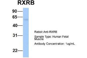 Image no. 2 for anti-Retinoid X Receptor, beta (RXRB) (N-Term) antibody (ABIN2782297)