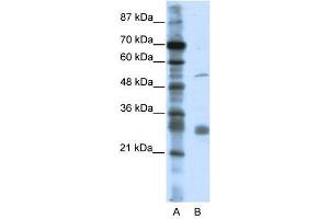 Image no. 1 for anti-Leucine Rich Repeat Containing 14 (LRRC14) (C-Term) antibody (ABIN927505)