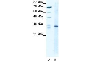 Image no. 1 for anti-Kruppel-Like Factor 3 (Basic) (KLF3) (N-Term) antibody (ABIN2779494)