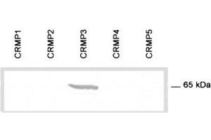 Image no. 1 for anti-Dihydropyrimidinase-Like 4 (DPYSL4) (C-Term) antibody (ABIN1107017)