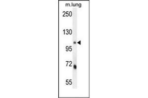 Image no. 1 for anti-MLX Interacting Protein (MLXIP) (AA 79-108), (N-Term) antibody (ABIN953462)
