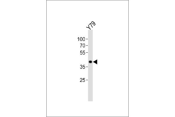 anti-Eukaryotic Translation Initiation Factor 3 Subunit H (EIF3H) (AA 70-99), (N-Term) antibody