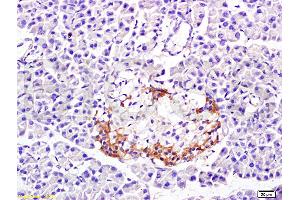 Formalin-fixed and paraffin embedded: rat pancreas tissue labeled with Anti-PP-1B Polyclonal Antibody (ABIN725465), Unconjugated at 1:300 followed by conjugation to the secondary antibody and DAB staining