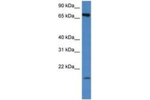 Image no. 1 for anti-Solute Carrier Family 5 (Sodium/glucose Cotransporter), Member 2 (SLC5A2) (AA 250-299) antibody (ABIN6747267)