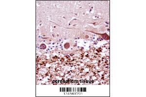 Image no. 2 for anti-Fanconi Anemia Complementation Group G (FANCG) (AA 540-568), (C-Term) antibody (ABIN5531155)