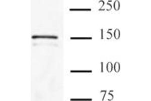 Image no. 2 for anti-CRISPR-Cas9 (N-Term) antibody (ABIN6971496)