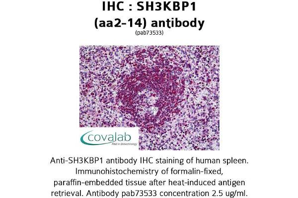 SH3KBP1 antibody  (N-Term)