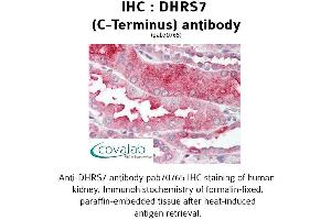 Image no. 1 for anti-Dehydrogenase/reductase (SDR Family) Member 7 (DHRS7) (C-Term) antibody (ABIN1733630)