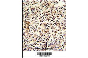 Image no. 2 for anti-Pericentriolar Material 1 (PCM1) (AA 1816-1845), (C-Term) antibody (ABIN391695)