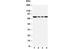 Image no. 6 for anti-Heat Shock 70kDa Protein 5 (Glucose-Regulated Protein, 78kDa) (HSPA5) (C-Term) antibody (ABIN3031155)