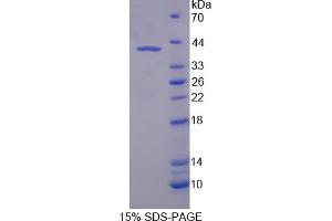 Image no. 1 for Optineurin (OPTN) (AA 1-300) protein (His tag) (ABIN6236904)