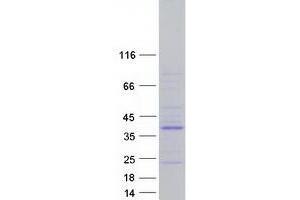 Image no. 1 for Protein Tyrosine Phosphatase, Non-Receptor Type 20B (PTPN20B) (Transcript Variant 8) protein (Myc-DYKDDDDK Tag) (ABIN2730114)