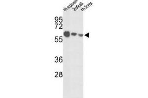 Image no. 2 for anti-Insulin-Like Growth Factor Binding Protein, Acid Labile Subunit (IGFALS) antibody (ABIN3003239)