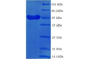 Image no. 1 for Fc Fragment of IgE, Low Affinity II, Receptor For (CD23) (FCER2) (AA 48-321) protein (His-SUMO Tag) (ABIN5709507)