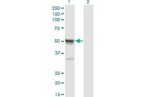 Image no. 2 for anti-Calsequestrin 2 (CASQ2) (AA 20-399) antibody (ABIN560181)