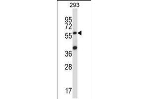 Image no. 2 for anti-Suppressor of Cytokine Signaling 6 (SOCS6) (AA 40-69), (N-Term) antibody (ABIN5532198)
