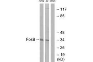 Image no. 1 for anti-FBJ Murine Osteosarcoma Viral Oncogene Homolog B (FOSB) (AA 12-61) antibody (ABIN1532614)