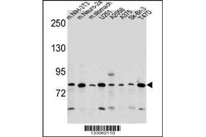 Image no. 1 for anti-Discoidin, CUB and LCCL Domain Containing 2 (DCBLD2) (AA 538-567), (C-Term) antibody (ABIN657748)