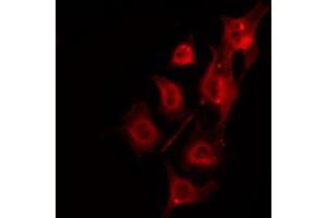Image no. 2 for anti-Dystrophia Myotonica-Protein Kinase (DMPK) antibody (ABIN6261318)