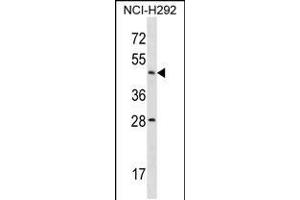 Image no. 1 for anti-Actin-Like 7b (Actl7b) (AA 69-97), (N-Term) antibody (ABIN5533660)