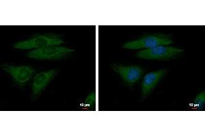Image no. 2 for anti-Fibroblast Growth Factor Receptor-Like 1 (FGFRL1) (Center) antibody (ABIN2855700)