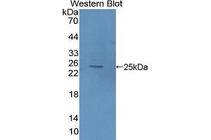 Image no. 2 for anti-High Mobility Group Box 2 (HMGB2) (AA 2-187) antibody (ABIN5013695)