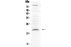 Image no. 1 for anti-Relaxin 1 (RLN1) antibody (ABIN5519057)