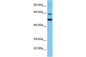 Image no. 1 for anti-Kelch-Like 6 (KLHL6) (N-Term) antibody (ABIN5516942)
