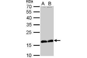 Image no. 3 for anti-Stathmin 1 (STMN1) (C-Term) antibody (ABIN2855912)
