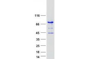 Image no. 1 for rho GTPase Activating Protein 27 (ARHGAP27) protein (Myc-DYKDDDDK Tag) (ABIN2730841)