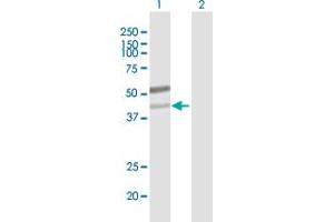 Image no. 1 for anti-UDP-GlcNAc:betaGal beta-1,3-N-Acetylglucosaminyltransferase 6 (Core 3 Synthase) (B3GNT6) (AA 1-384) antibody (ABIN531224)