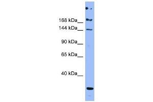 Image no. 3 for anti-Apolipoprotein B (APOB) (Middle Region) antibody (ABIN636056)