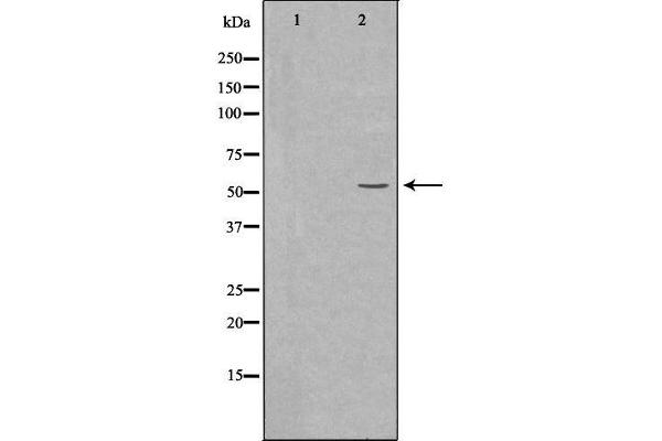 anti-BAI1-Associated Protein 2-Like 2 (BAIAP2L2) (Internal Region) antibody