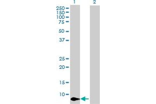 anti-Chemokine (C-X-C Motif) Ligand 11 (CXCL11) (AA 1-94) antibody