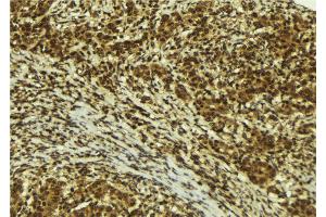 Image no. 3 for anti-Zinc Finger Protein 295 (ZNF295) antibody (ABIN6266124)